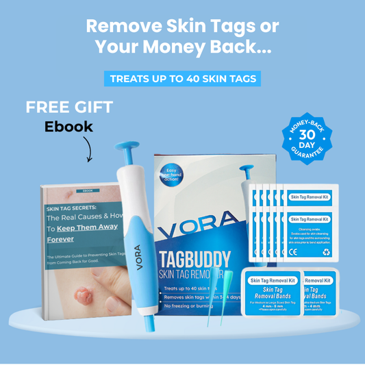 MrTagmate™ – No More Skin Tags