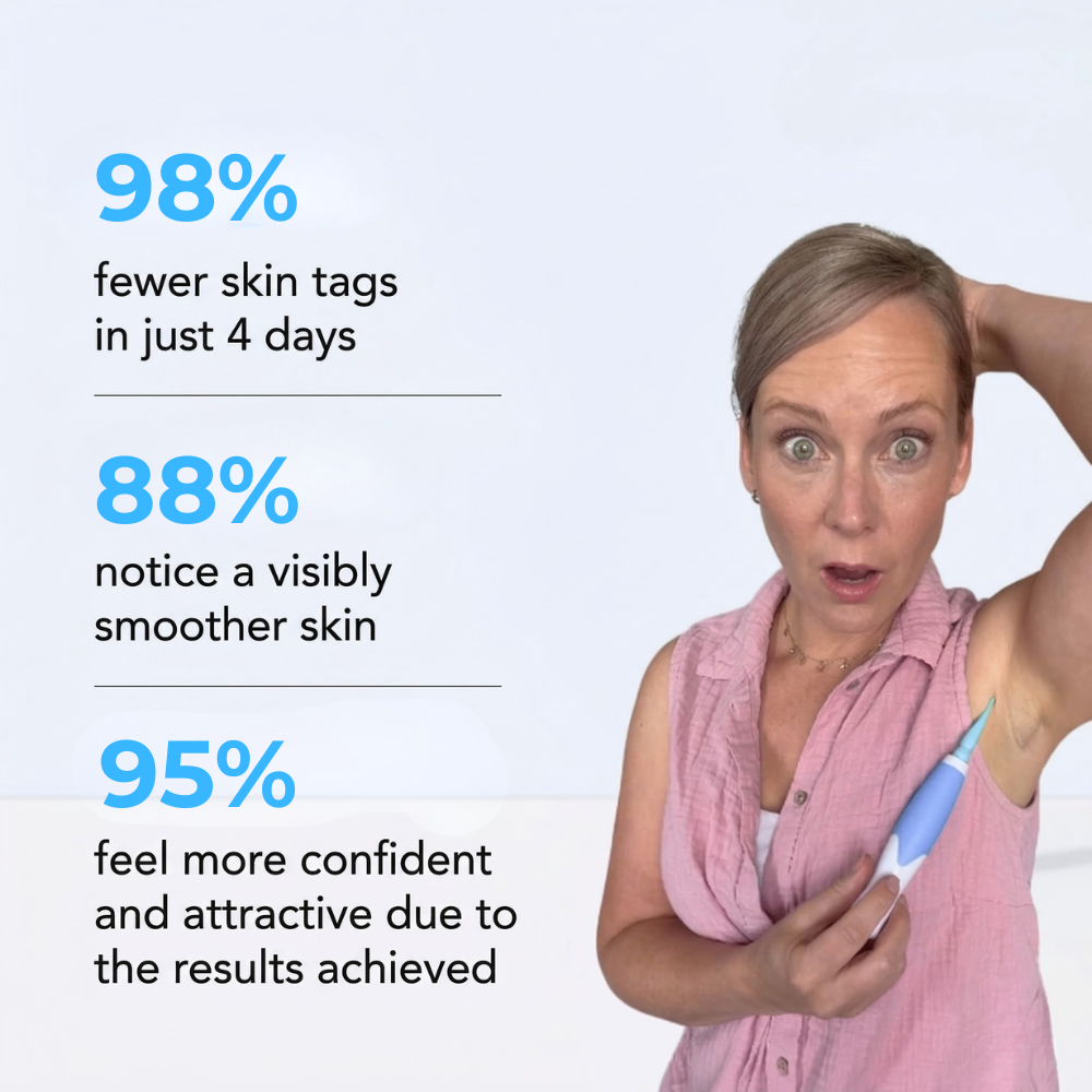 MrTagmate™ – No More Skin Tags