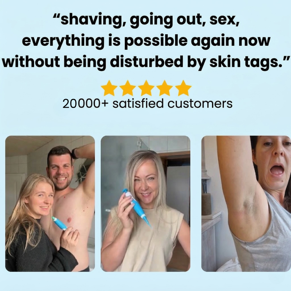 MrTagmate™ – No More Skin Tags